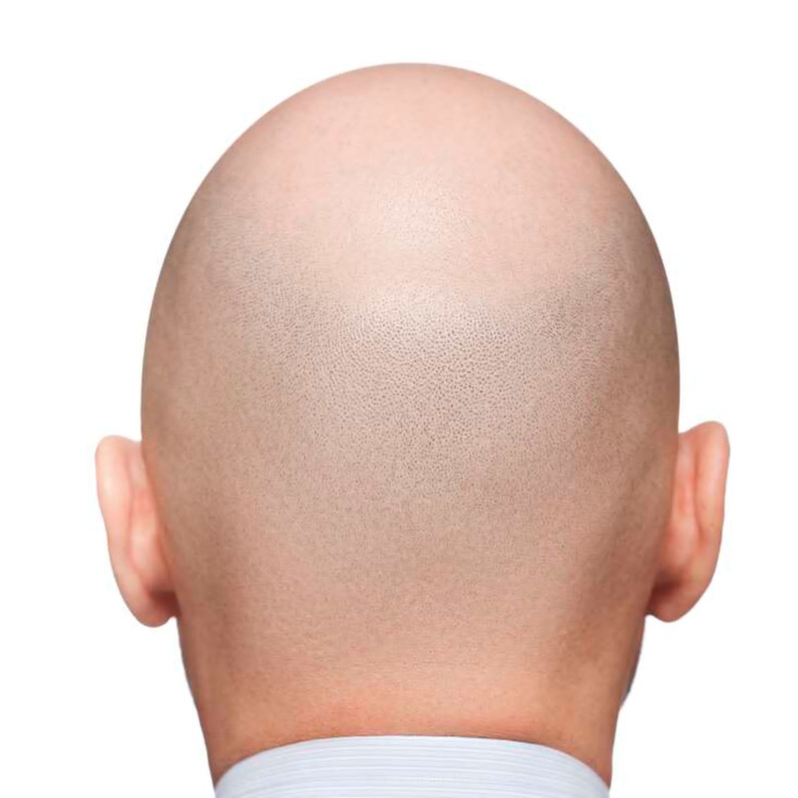 Bald Coin – Medium