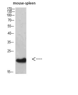 Bcl-2 Polyclonal Antibody Review