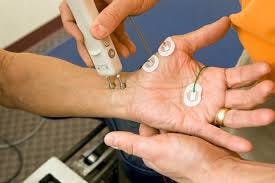 Nerve Testing in Raleigh : Expert Care You Can Trust at APC Pain Care