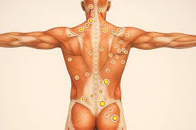 Restore Spine and Pain Center Provides Myofascial Pain Treatment in Apex