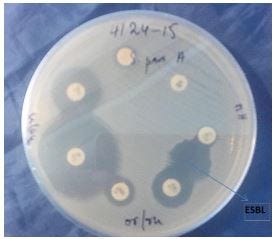 Antimicrobial status of salmonella meningitis in Niger