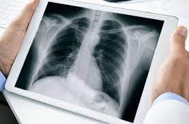 Empowering Patients: The Rise of Mobile X-Ray Services in Healthcare