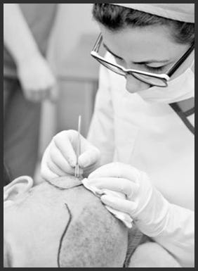 How Sapphire FUE Hair Transplant Turkey Helps Achieve Higher Hair Density