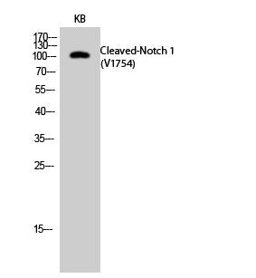 Cleaved-Notch 1 (V1754) Polyclonal Antibody Released