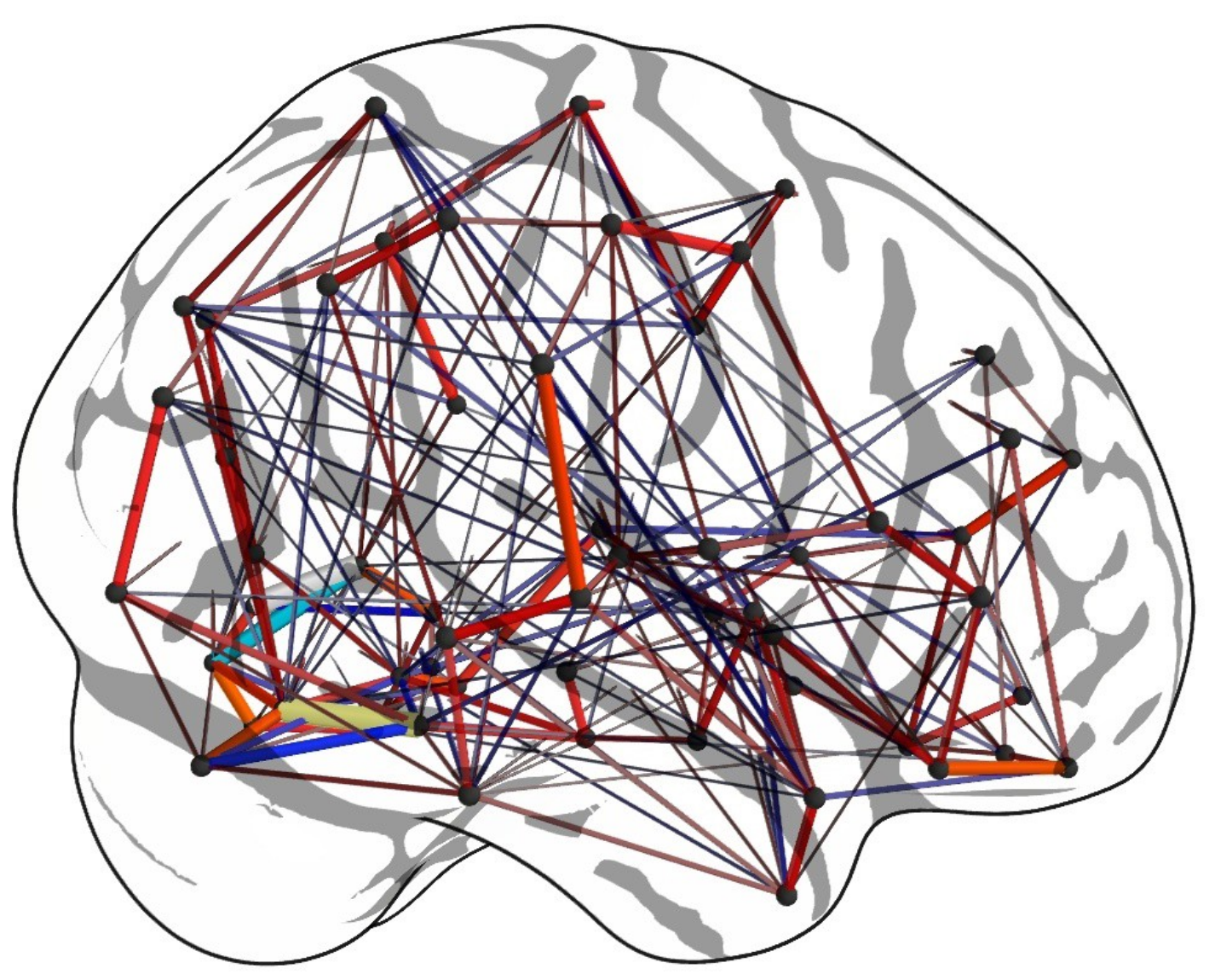 Graphic model. Коннектом человека проект. Коннектом мозга. Арты нейросети. Теория графов абстракция.