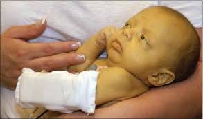 Benefits of Vaccines — Hepatitis A