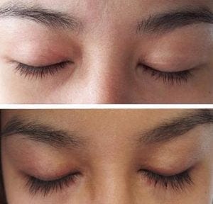 NeutraLuxe Lash MD The Way To Get Longer Lashes | by Top Beauty Guide |  Medium