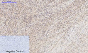 MMP-2 Polyclonal Antibody Review