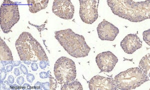 mTOR Polyclonal Antibody Review