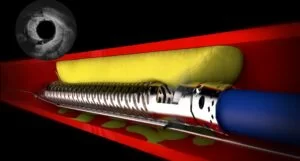 The Power of Educational Medical Animation