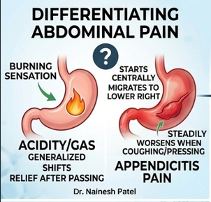 Gas Pain vs Appendicitis: How to Tell the Difference?