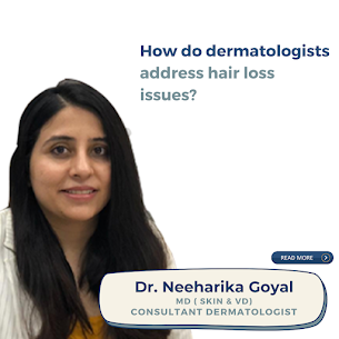 How do dermatologists address hair loss issues? | by Dr Neeharika Goyal