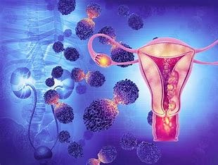 Cervical Cancer, A Silent Threat