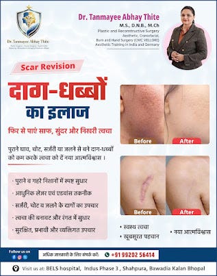 Scar Revision Treatment in Bhopal — Advanced Care by Dr. Tanmayee Abhay Thite