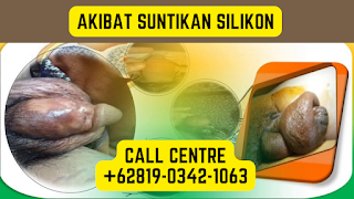 Adakah Terdapat Sebarang Ubat Untuk Memusnahkan Suntikan Silikon Pada Buah Zakar Lelaki?