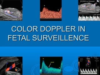 Doppler Ultrasound in Obstetrics: More Than Just Fetal Growth Assessment