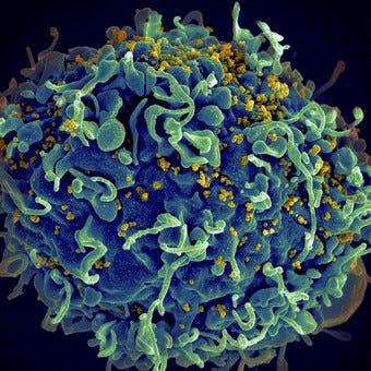 Un tratamiento con sangre del cordón umbilical, la novedad para tratar el VIH: ¿Hay chances de…