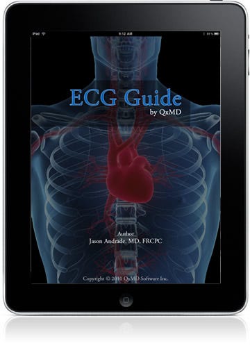 The ECG Guide for iPad | by QxMD | Medium
