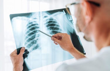 Bringing X-Ray Technology to Your Doorstep: The Rise of Mobile Imaging Services