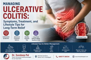 Managing Ulcerative Colitis