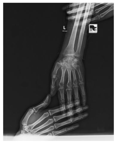 Biomedical Image Analysis Part 2 —  Exploring Image Intensities with Histograms, CDF Normalization…