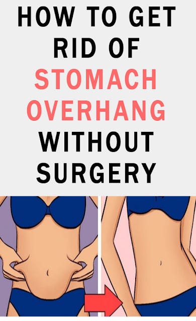 10 tips on how to get rid of stomach overhang without surgery - Katherine  Collins - Medium