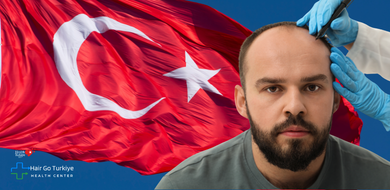 Transplante Capilar na Turquia: Vale a Pena? Tudo o Que Você Precisa Saber em 2026