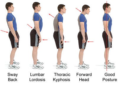 Do Back Brace For Posture Really Works | by 3G Tech Solutions | aiplaits |  Medium