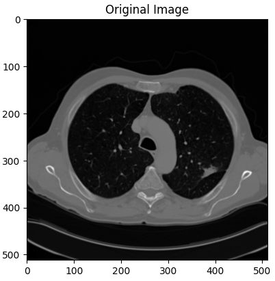 Segmentation of CT Scan with Python | by Scripnic Dinu | Medium
