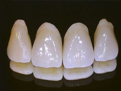 Teeth Braces in Bangalore — Choose Invisible Aligners for a Confident Smile