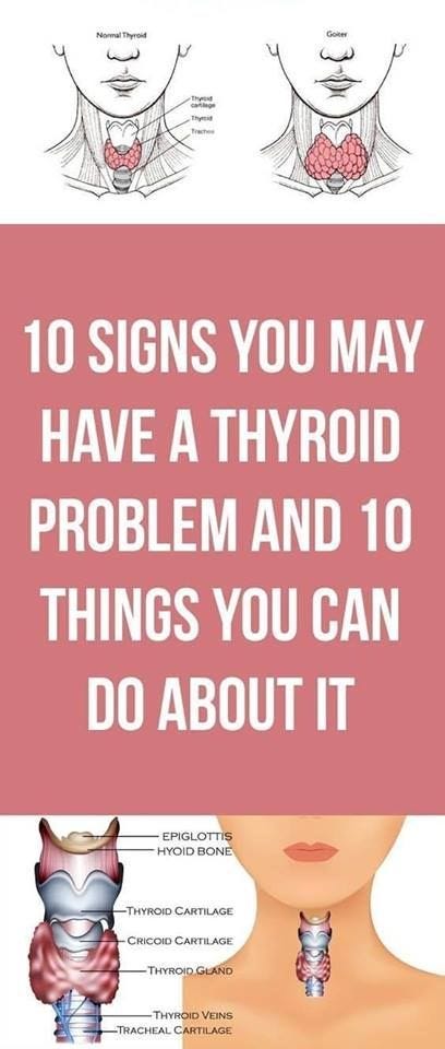 10 Signs Your Feet Are Warning You About A Thyroid Problem - Linda ...