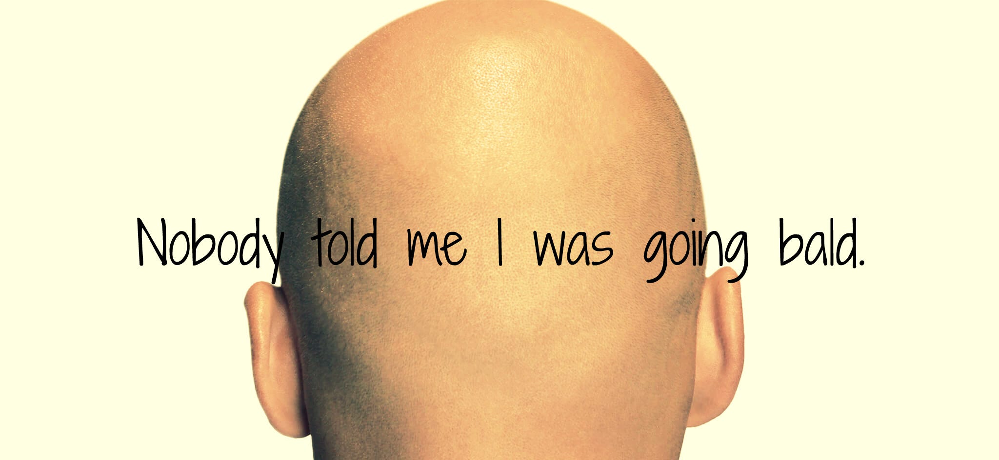 Nobody told me I was going bald.. Age 17 was the beginning of the end… | by  Tim Hammill | Medium