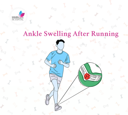 Ankle Swelling After Running: Ligament Strain Red Flags