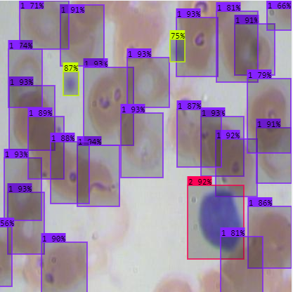 Automated Blood Cell Classification Using RoboFlow and YOLOv8 | by ...