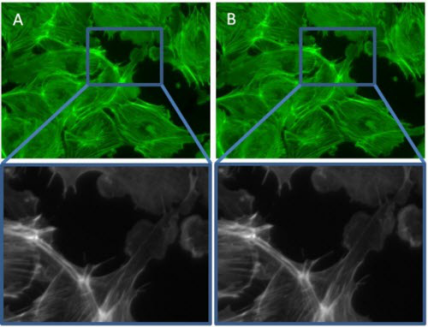 How to choose a right camera for your Fluorescence Microscope ?