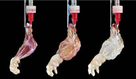 Prosthetics