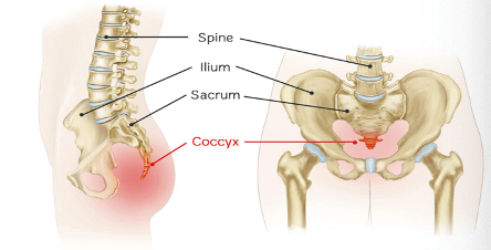 Coccydynia — Why Does My Tailbone Hurt?