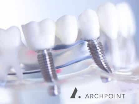 Discover All-on-Fours: The Superior Dental Implants Fort Worth TX