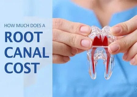 root canal treatment cost explained: what affects the final price