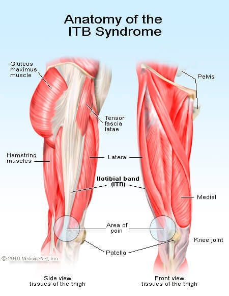 Iliotibial Band Syndrome in Runners, by The Long Haul