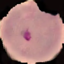 How to classify Malaria Cells using Convolutional neural network 3 classify Malaria Cells using Convolutional neural network