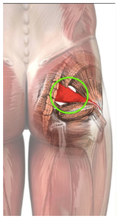 Sciatica & Piriformis Syndrome in Runners, by Alina Kennedy