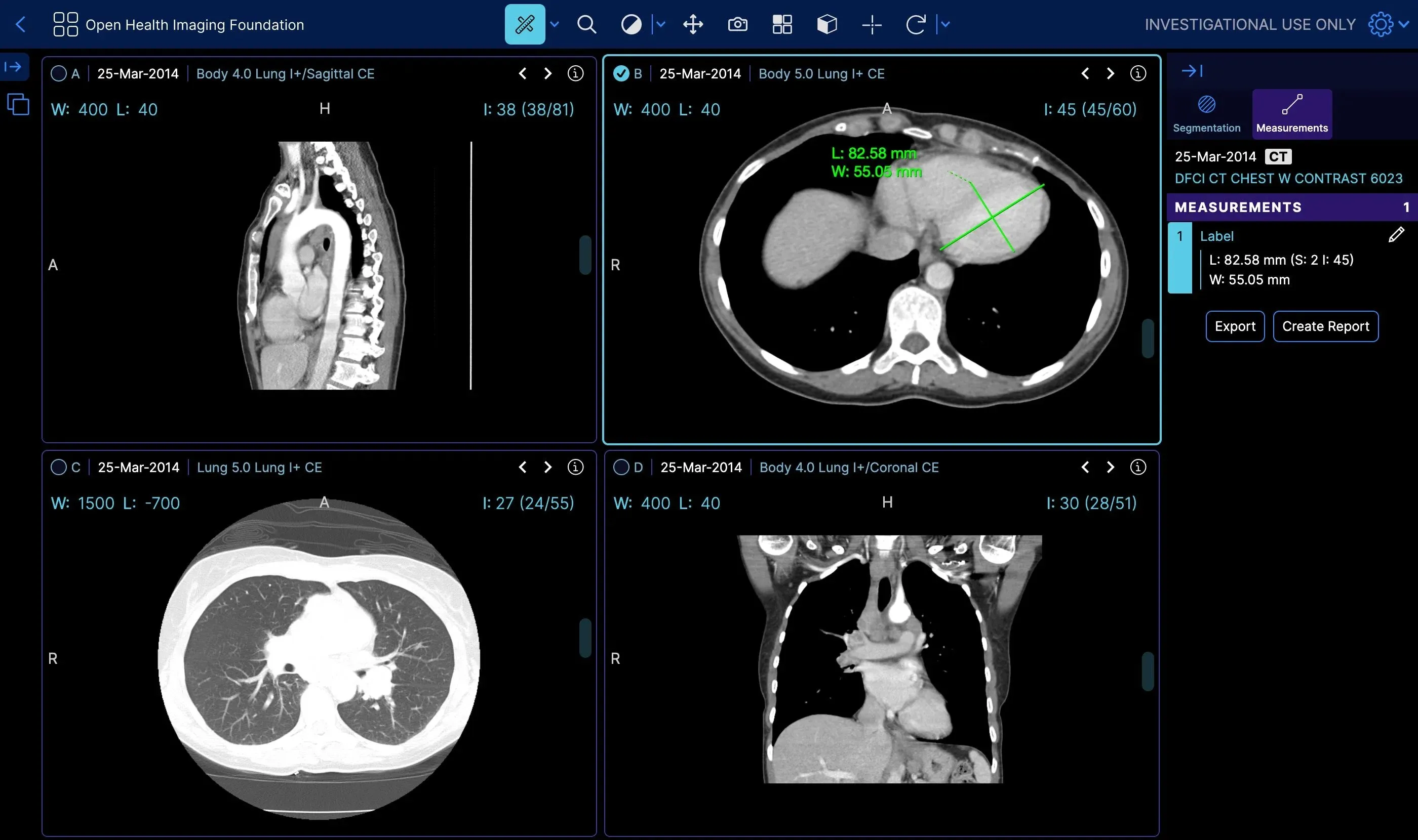 MeSys Insight