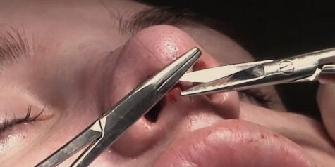Oral Cancer Surgeon: Everything You Should Know Before Choosing the Right Specialist