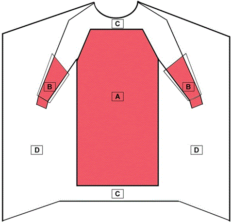 Critical zones for an FDA class II surgical gown; Source: https://www.fda.gov/medical-devices/personal-protective-equipment-infection-control/medical-gowns