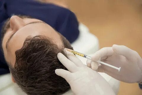 Discover PRP Hair Treatment in Lahore: Promoting Hair Growth and ...