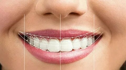smile designing: transform your look with customized dental aesthetics