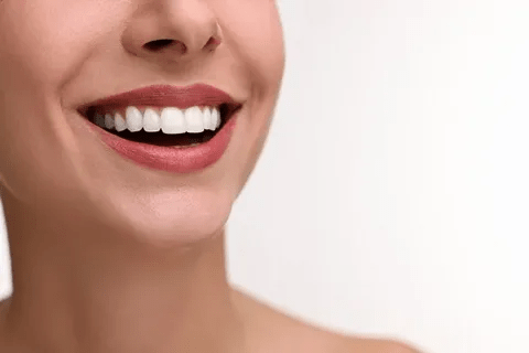 step-by-step guide to a complete smile makeover