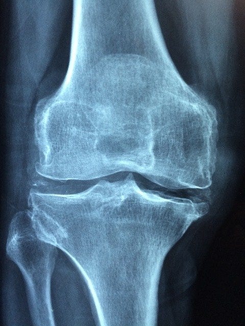 Top 10 best food for strengthening bones | How to increase bone strength naturally