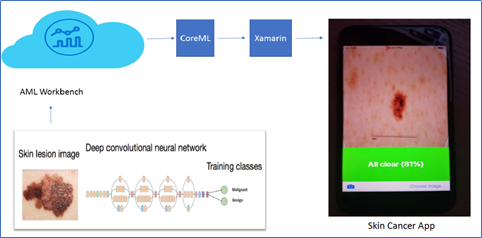 Intelligent Edge: Building a Skin Cancer Prediction Application using Azure Machine  Learning, CoreML and Xamarin | by anusua trivedi | MICCAI Educational  Initiative | Medium